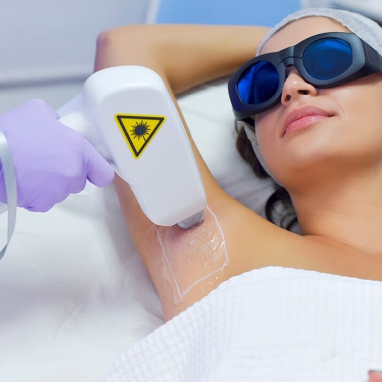 uzla Lazer Epilasyon - Veine Beauty | Kalıcı Çözüm